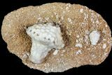 Fossil Crinoids (Uperocrinus & Macrocrinus) - Missouri #80795-1